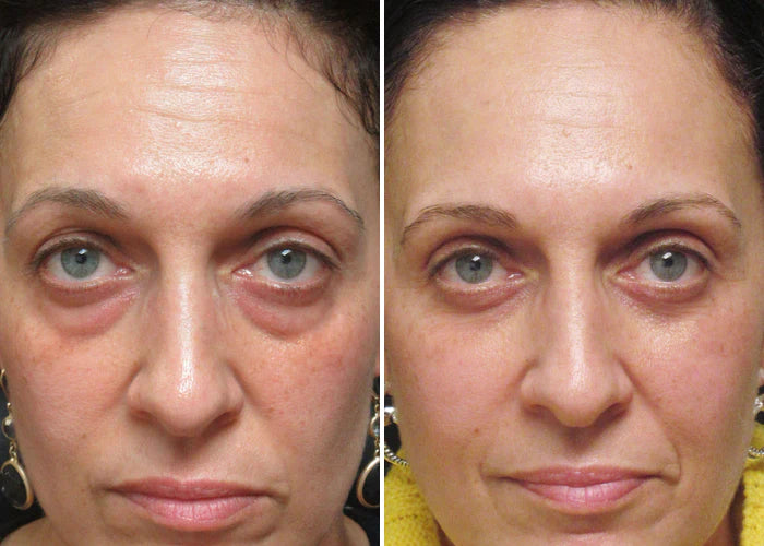 SERUM TODO EN UNO PARA LA RENOVACION DE TUS OJOS!