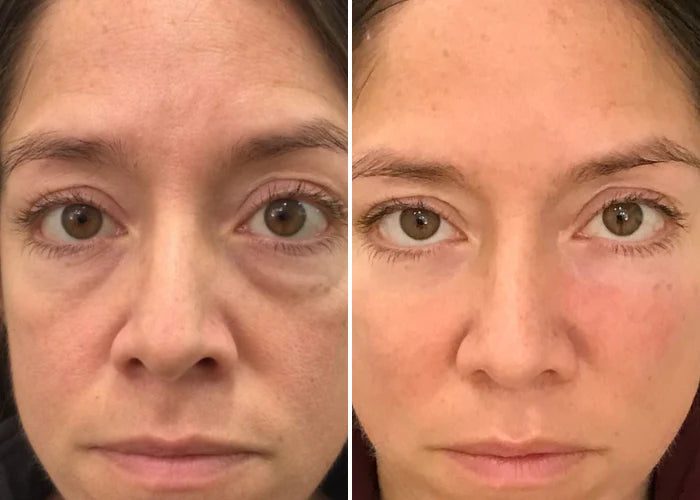 SERUM TODO EN UNO PARA LA RENOVACION DE TUS OJOS!