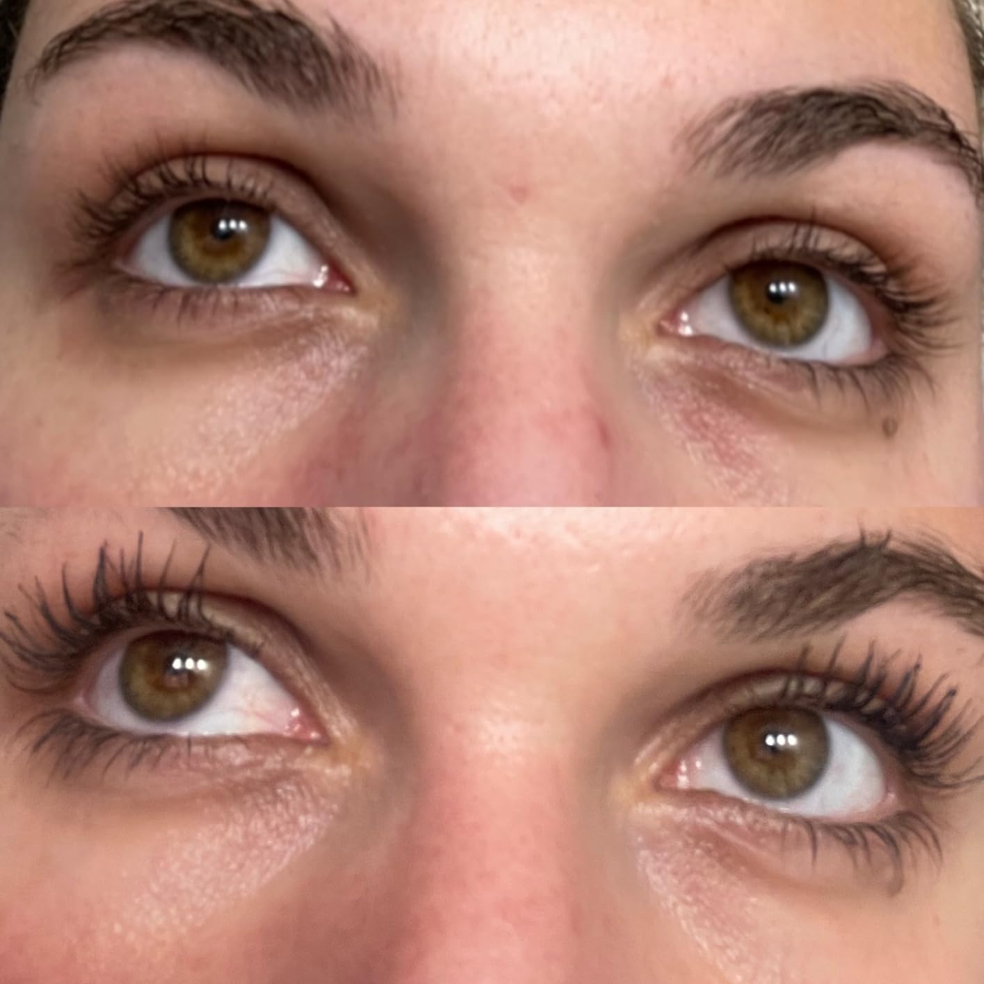 PARCHES MICROGLOW REJUVENECEDOR DE OJOS!