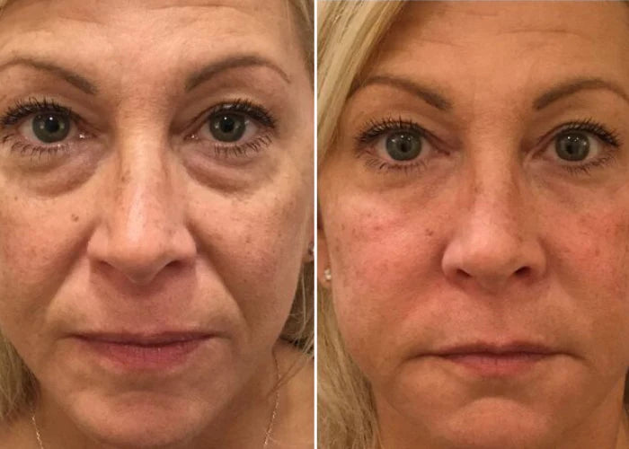 SERUM TODO EN UNO PARA LA RENOVACION DE TUS OJOS!