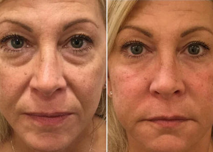 SERUM TODO EN UNO PARA LA RENOVACION DE TUS OJOS!