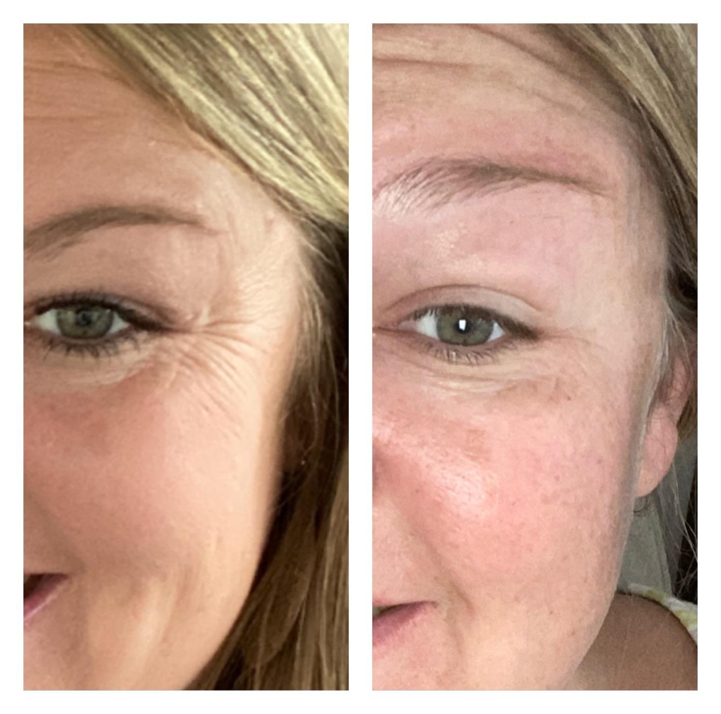 PARCHES MICROGLOW REJUVENECEDOR DE OJOS!