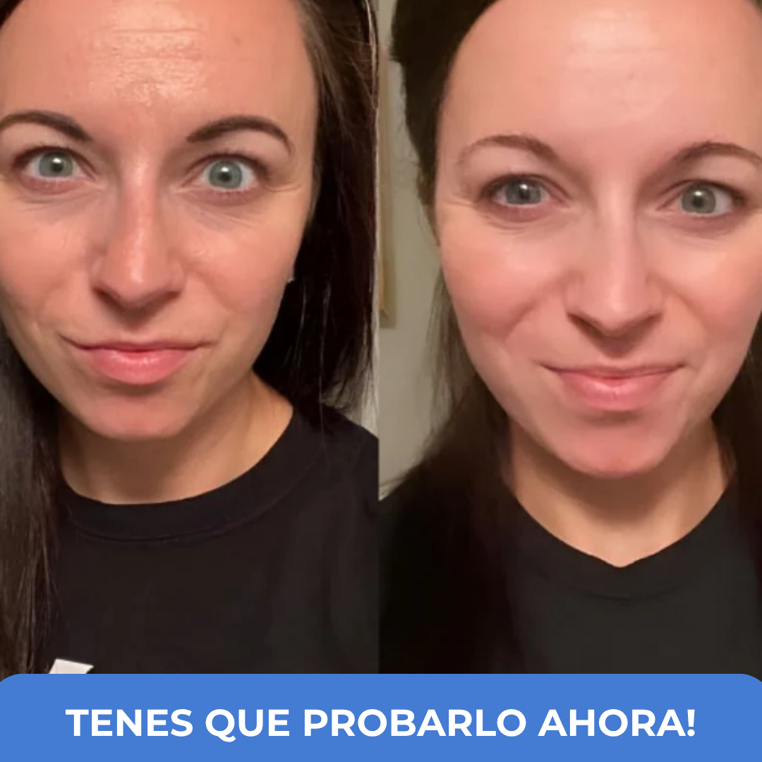 SERUM TODO EN UNO PARA LA RENOVACION DE TUS OJOS!