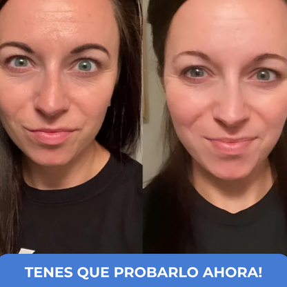 SERUM TODO EN UNO PARA LA RENOVACION DE TUS OJOS!
