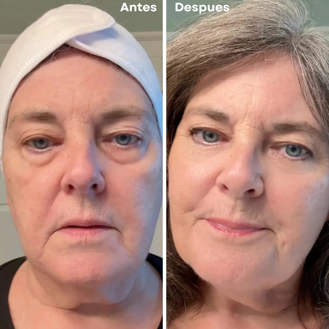 CONTORNO TODO EN UNO PARA LA RENOVACION DE TUS OJOS!