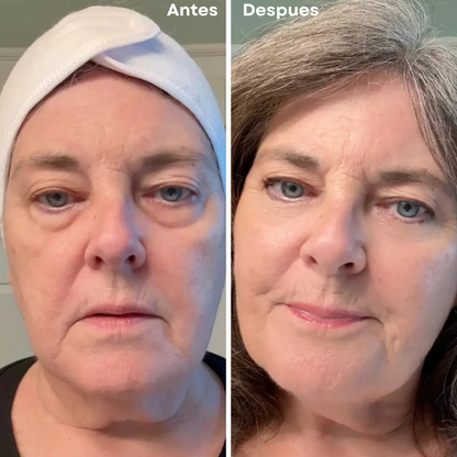 CONTORNO TODO EN UNO PARA LA RENOVACION DE TUS OJOS!