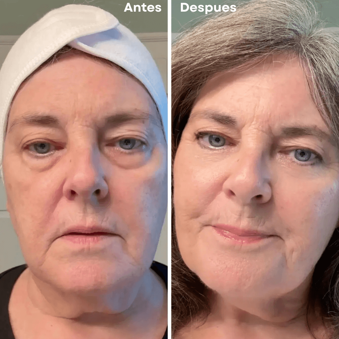 PARCHES MICROGLOW REJUVENECEDOR DE OJOS!