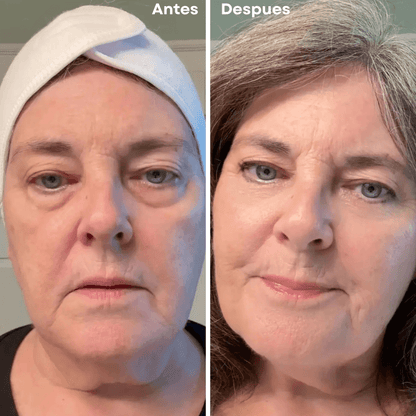 PARCHES MICROGLOW REJUVENECEDOR DE OJOS!