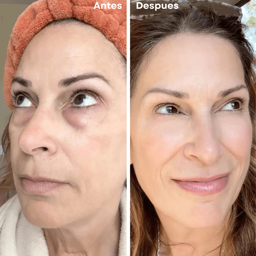 PARCHES MICROGLOW REJUVENECEDOR DE OJOS!